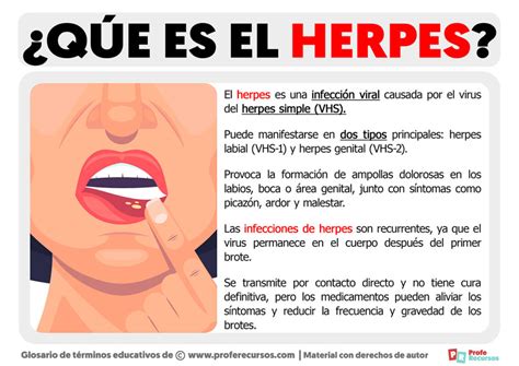 como es el herpes-1